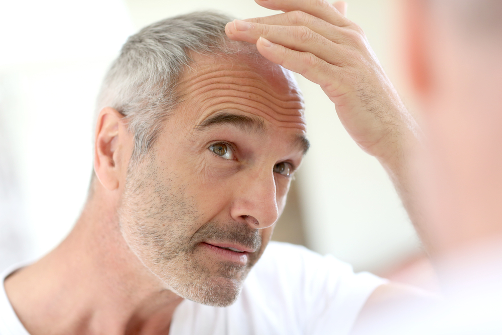male hair loss patient