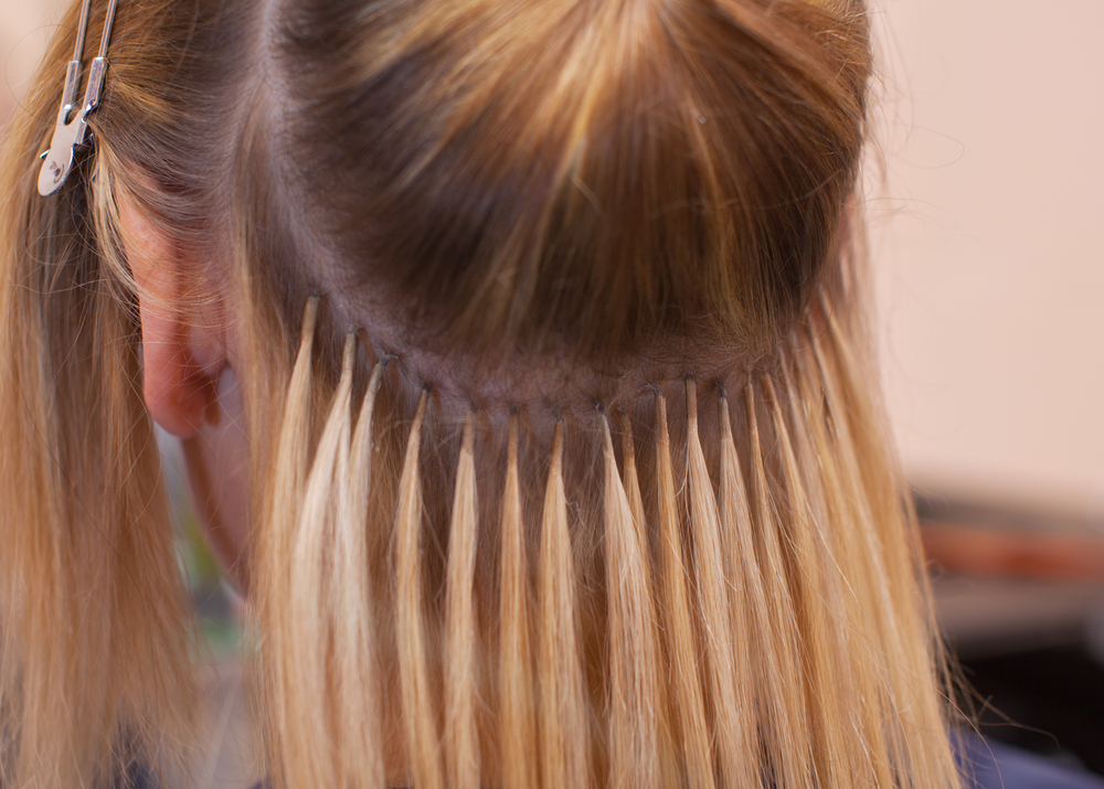 early stage of traction alopecia